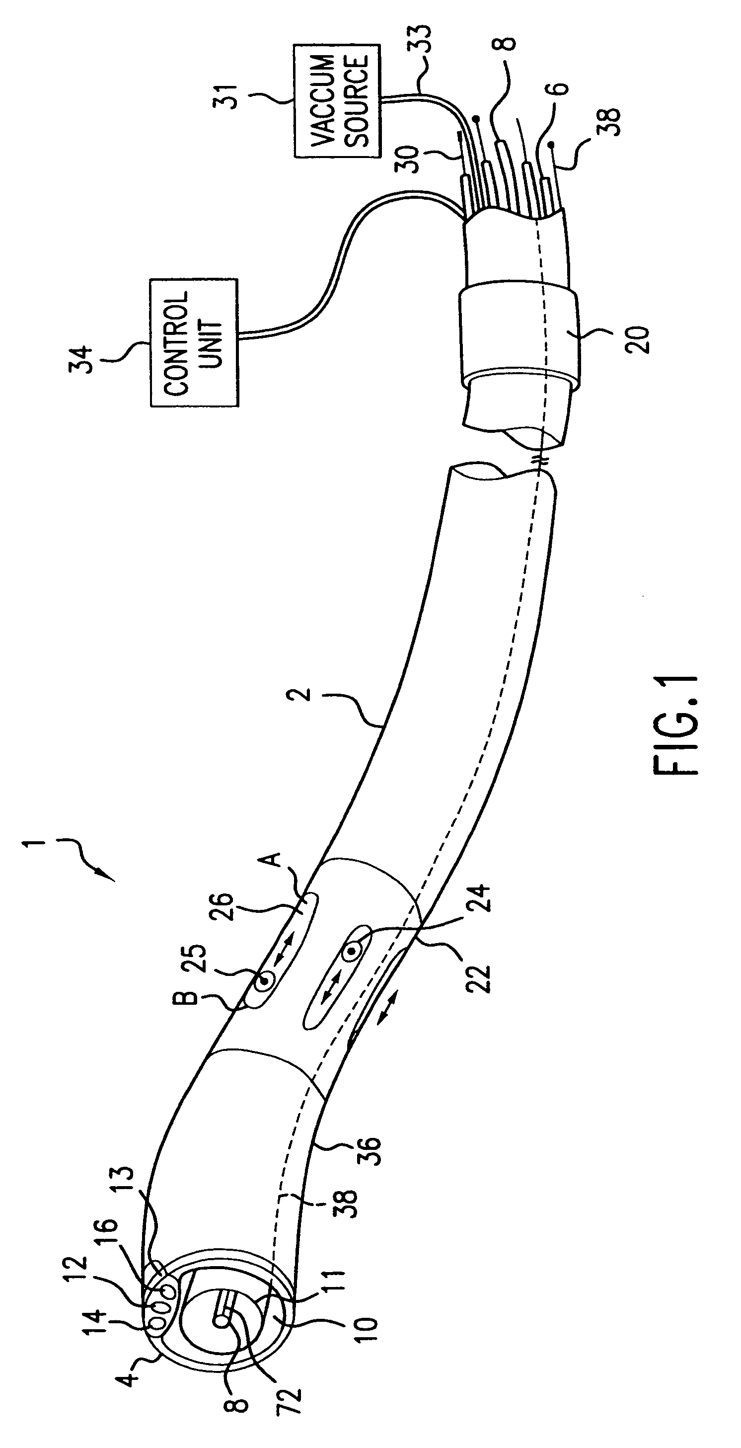 Catheter introducer system for exploration of body cavities