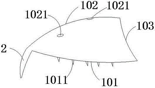 Medical acetabulum compensation prosthesis