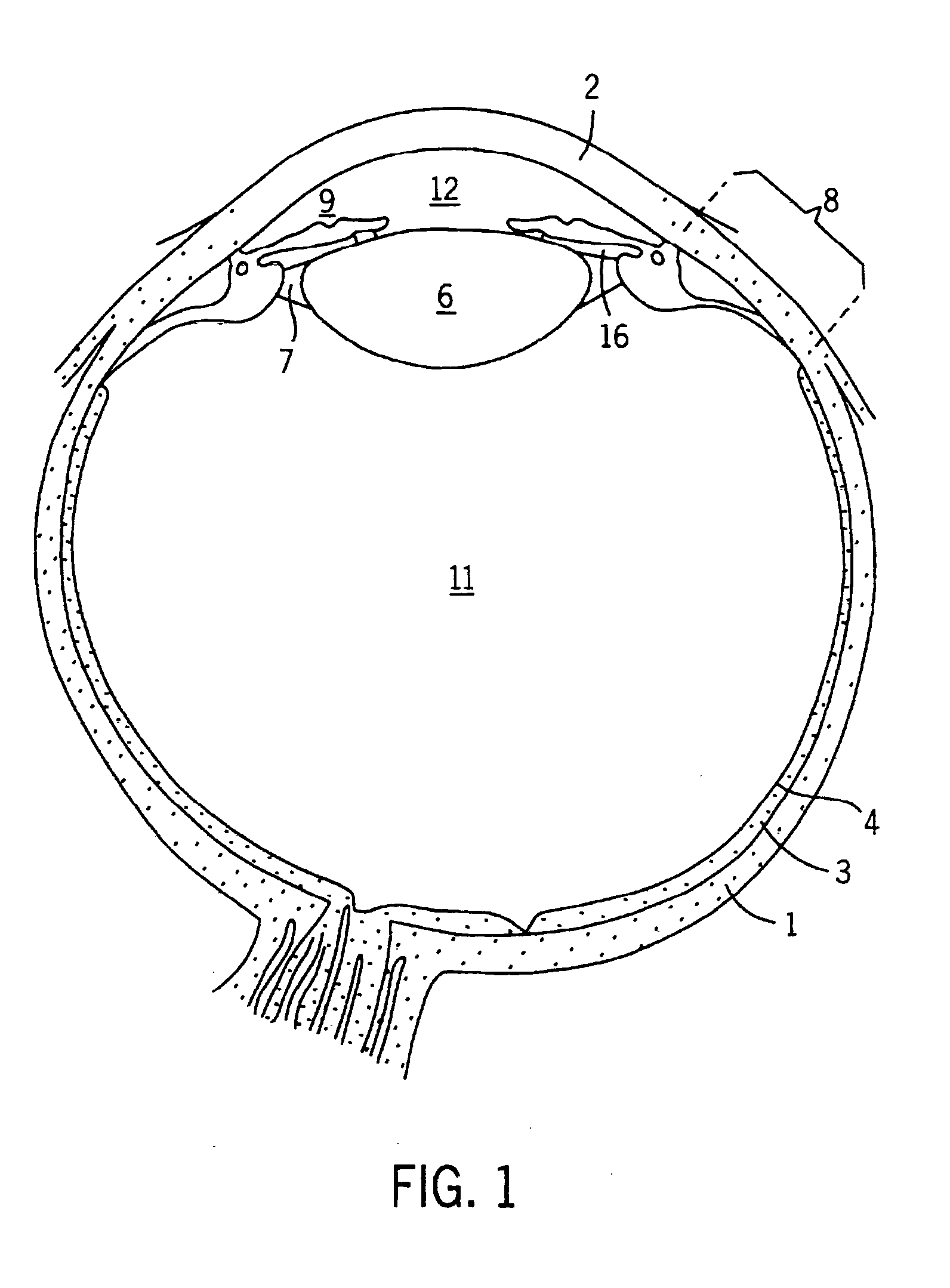 Implantable pump apparatuses