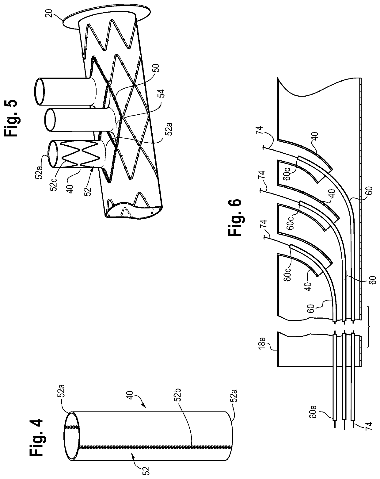 Branched frozen elephant trunk device and method