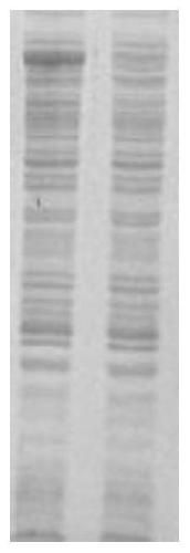 Recombinant chimeric antigen of treponema pallidum as well as preparation method and use thereof