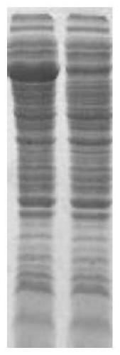 Recombinant chimeric antigen of treponema pallidum as well as preparation method and use thereof