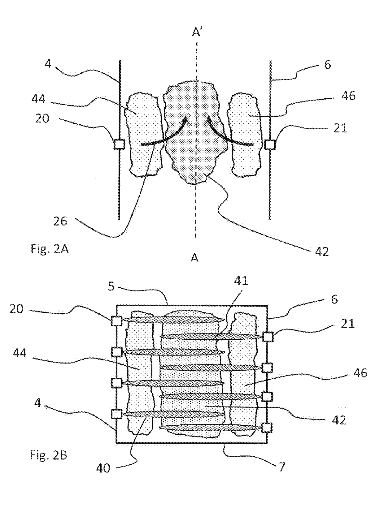 Over fire arrangement and method