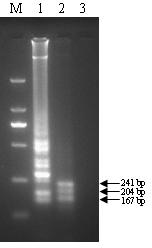 Loop-mediated isothermal amplification method for detecting salmonella in food and reagent kit