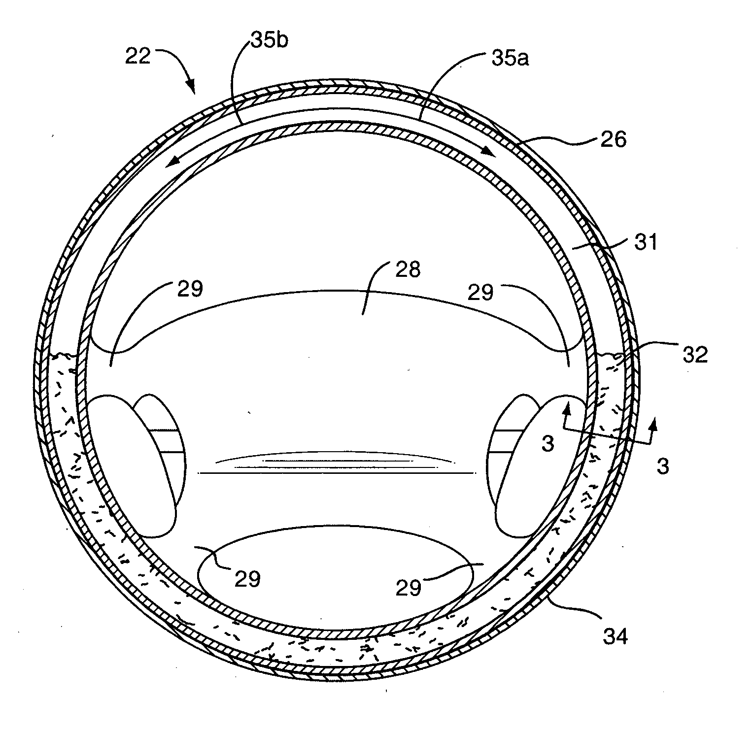 Steering wheel damper