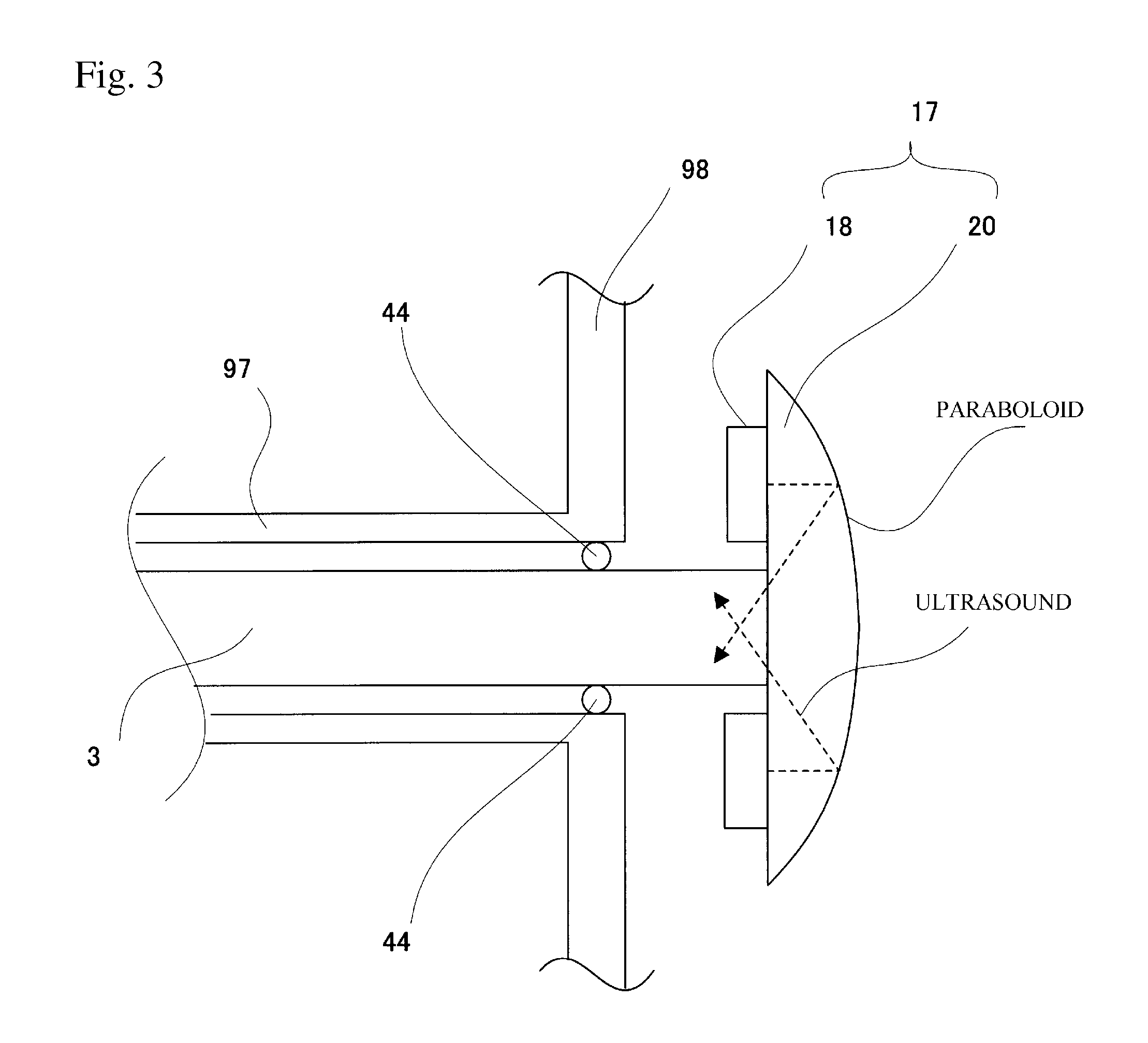 Ultrasound, Probe, Ultraonograph, And Ultrasonigraphy