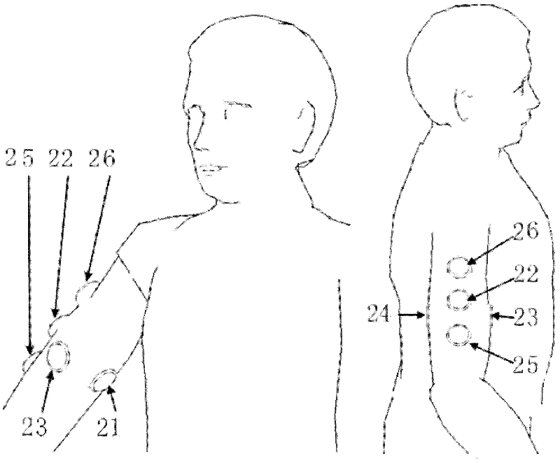 Myoelectric prosthetic hand force tactile feedback method and tactile feedback myoelectric prosthetic hand system