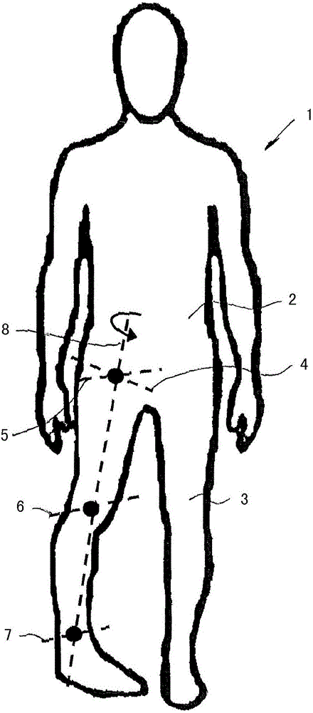 Leg orthosis and orthosis