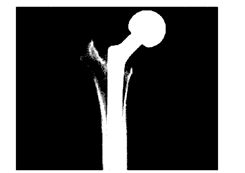 Method for strengthening joint stability by using rhBMP-2 release coating on surface of artificial joint