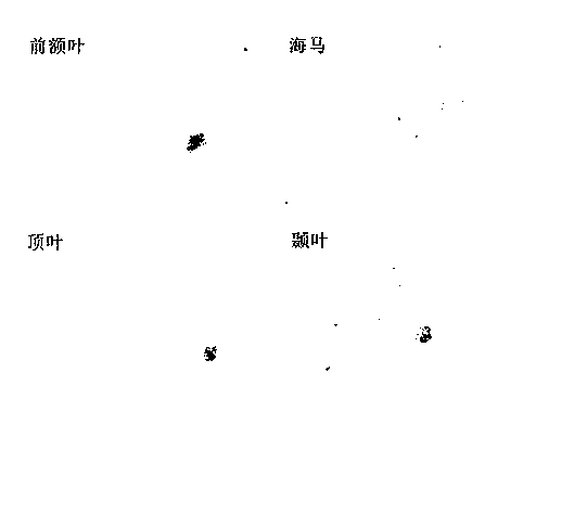 Method for establishing animal model for senile dementia, special liquid medicine and dosing device