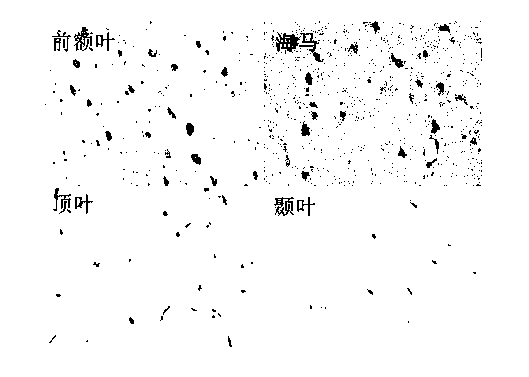 Method for establishing animal model for senile dementia, special liquid medicine and dosing device