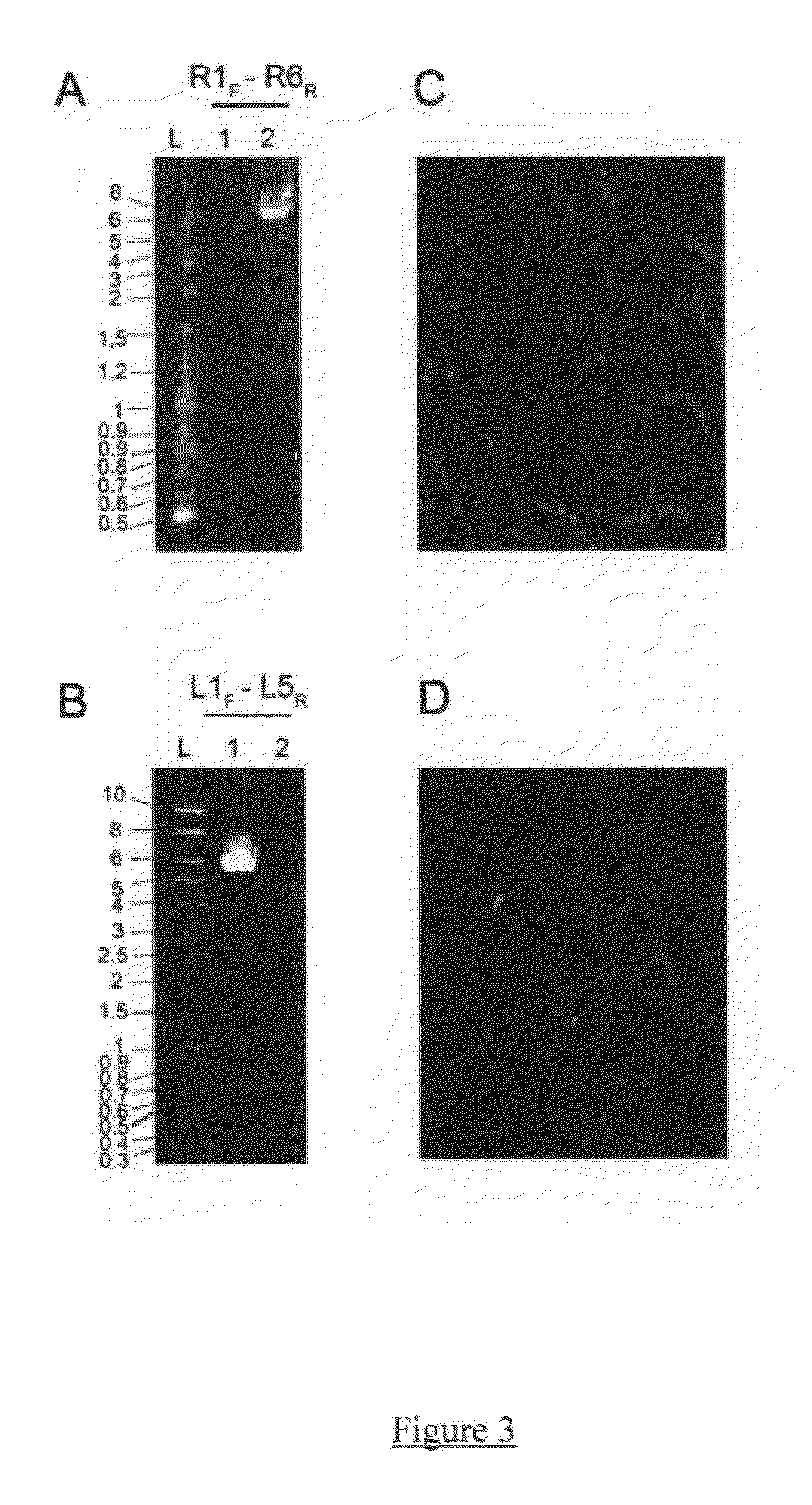 Assessment of cancer risk based on rnu2 cnv and interplay between rnu2 cnv and brca1