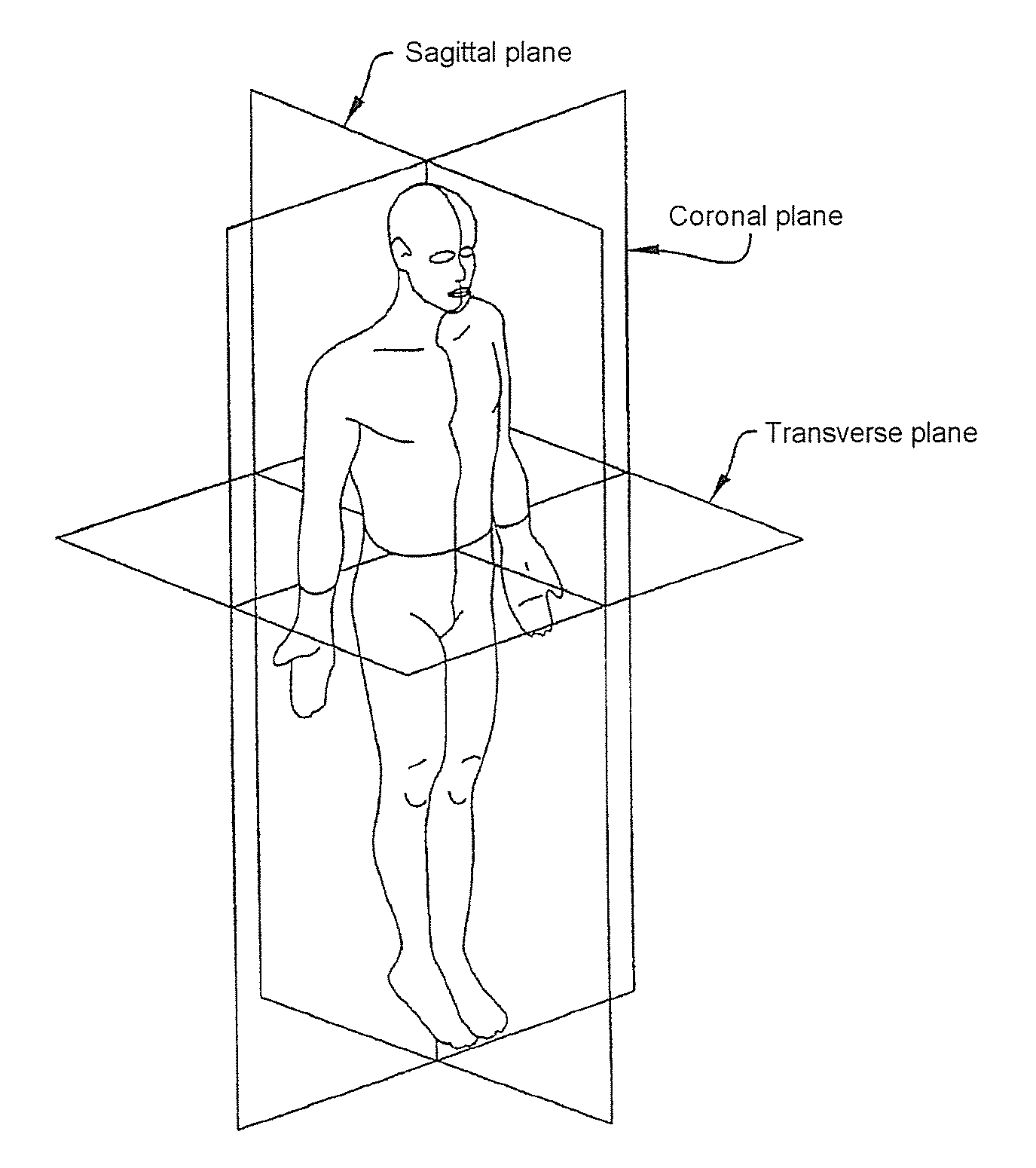 Method and device for image processing, notably to process medical images