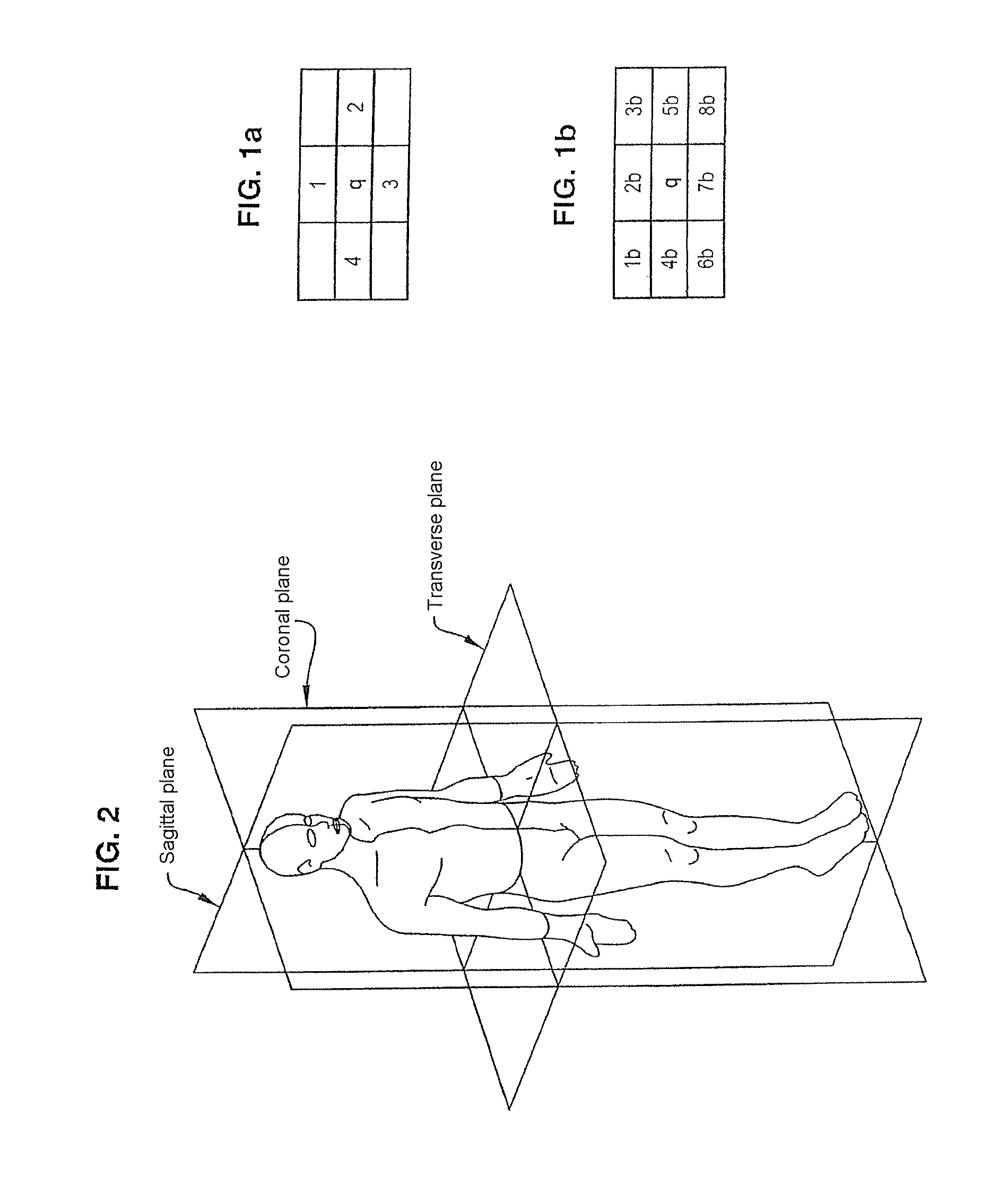 Method and device for image processing, notably to process medical images