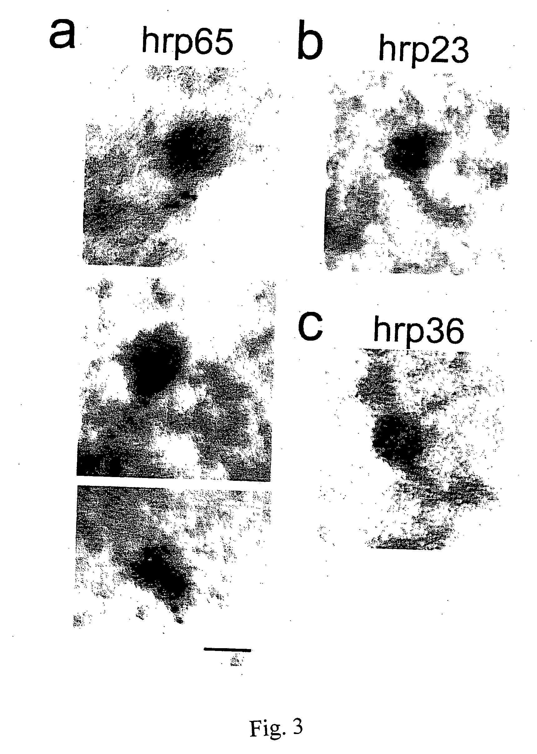 Method for localizing and identifying isotopes