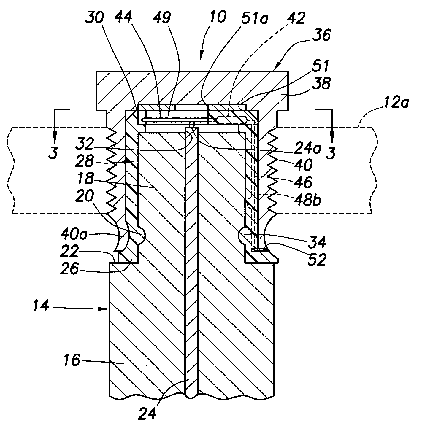 Resistored anode construction