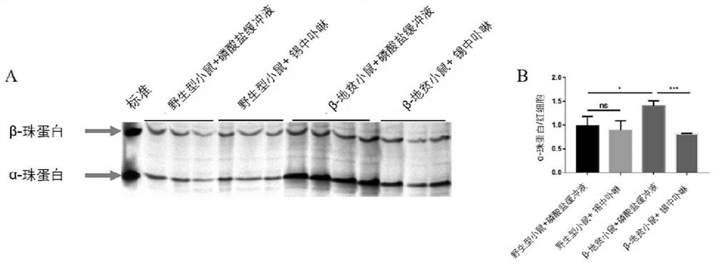 Application of porphyrin in tin in preparation of medicines for treating thalassemia