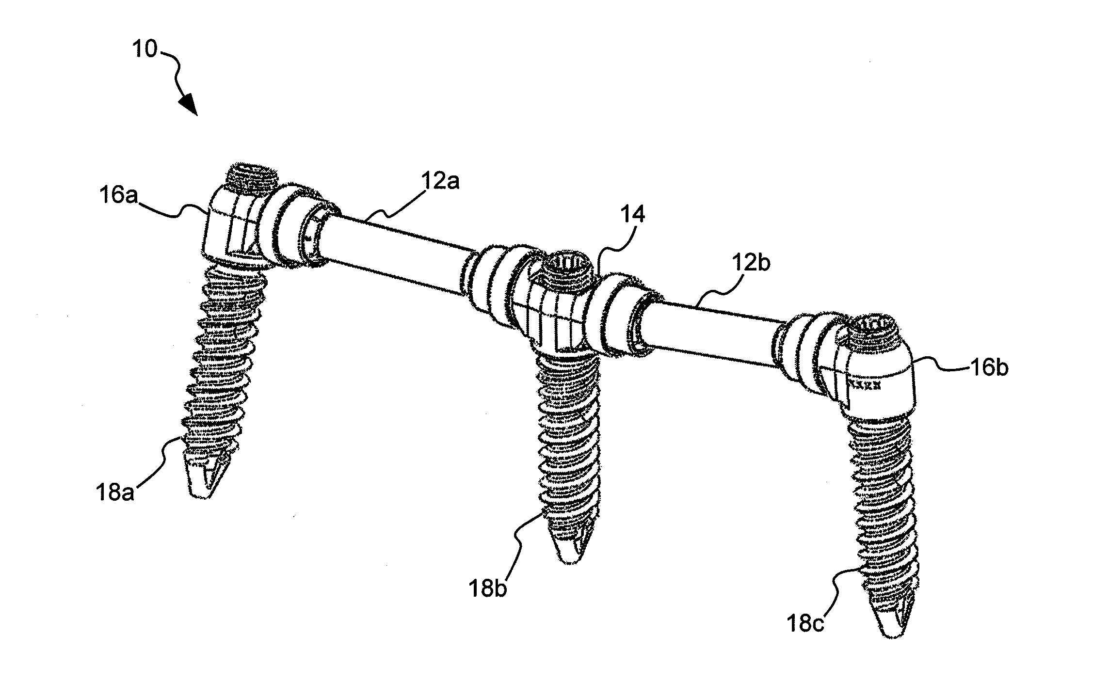 Coupling system for surgical construct