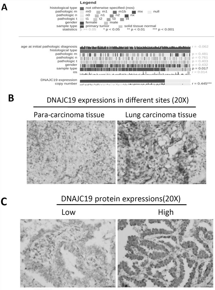 Application of DNAJC19 gene as target in preparation of drug for treating non-small cell lung cancer (NSCLC)