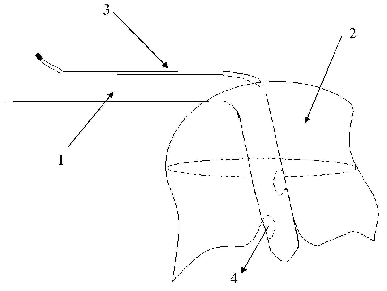 Pressurized drainage tube for chest