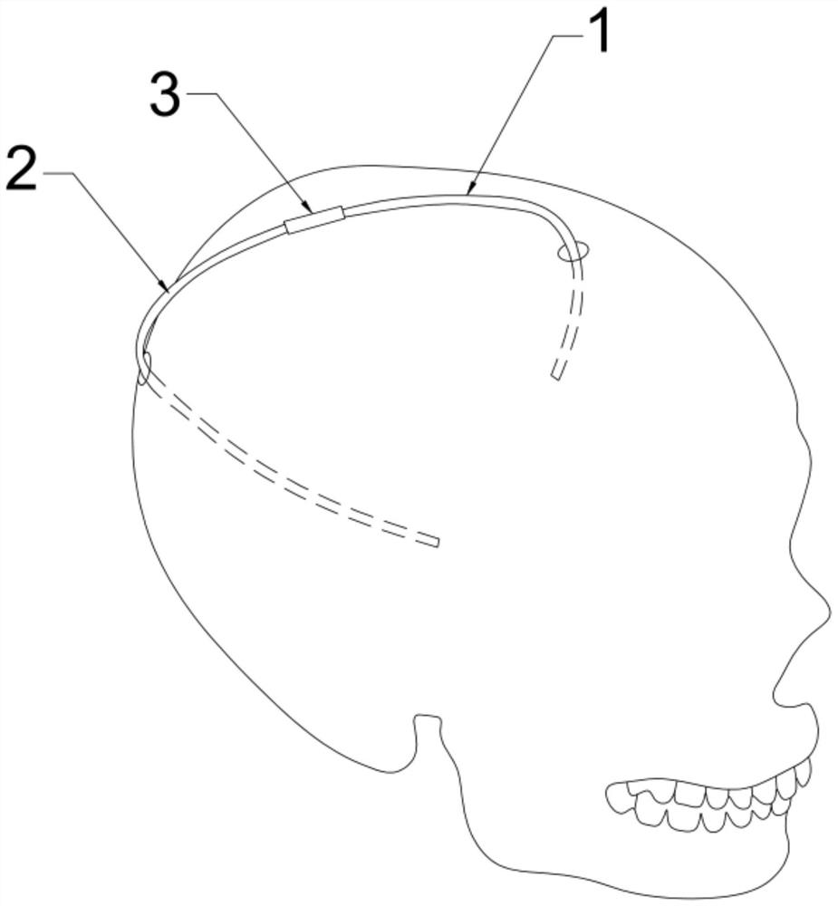 Bypass system for ventricular bypass surgery