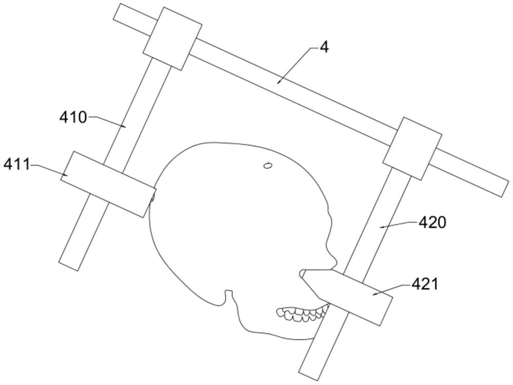 Bypass system for ventricular bypass surgery