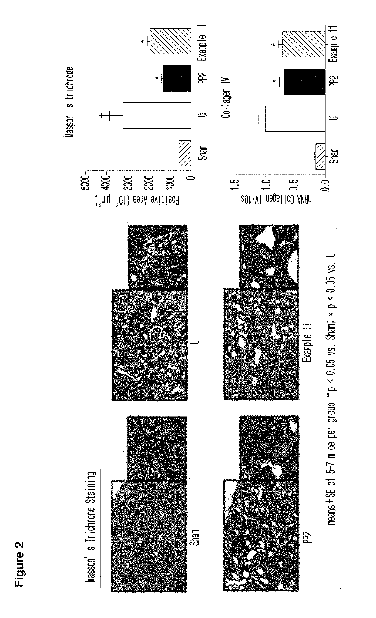 Novel imidazopyridine derivative, method for preparing same, and pharmaceutical composition containing same as active ingredient for preventing or treating cancer