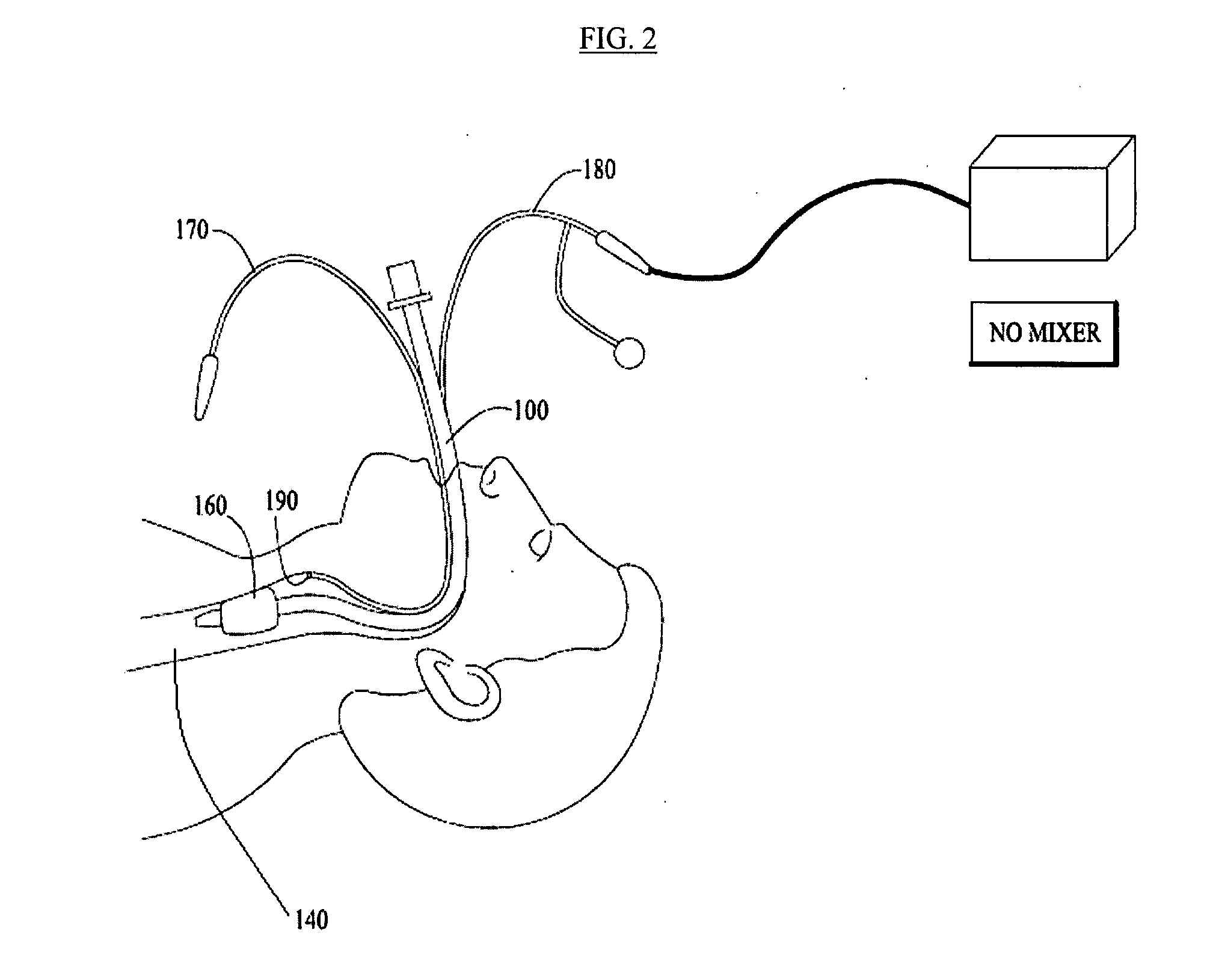 Method and device to prevent ventilator acquired pneumonia using nitric oxide