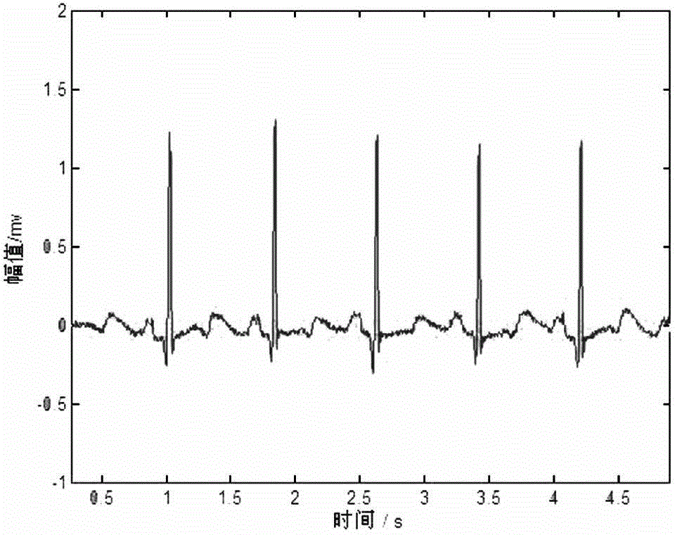 Automatic classification method for electrocardiogram signals