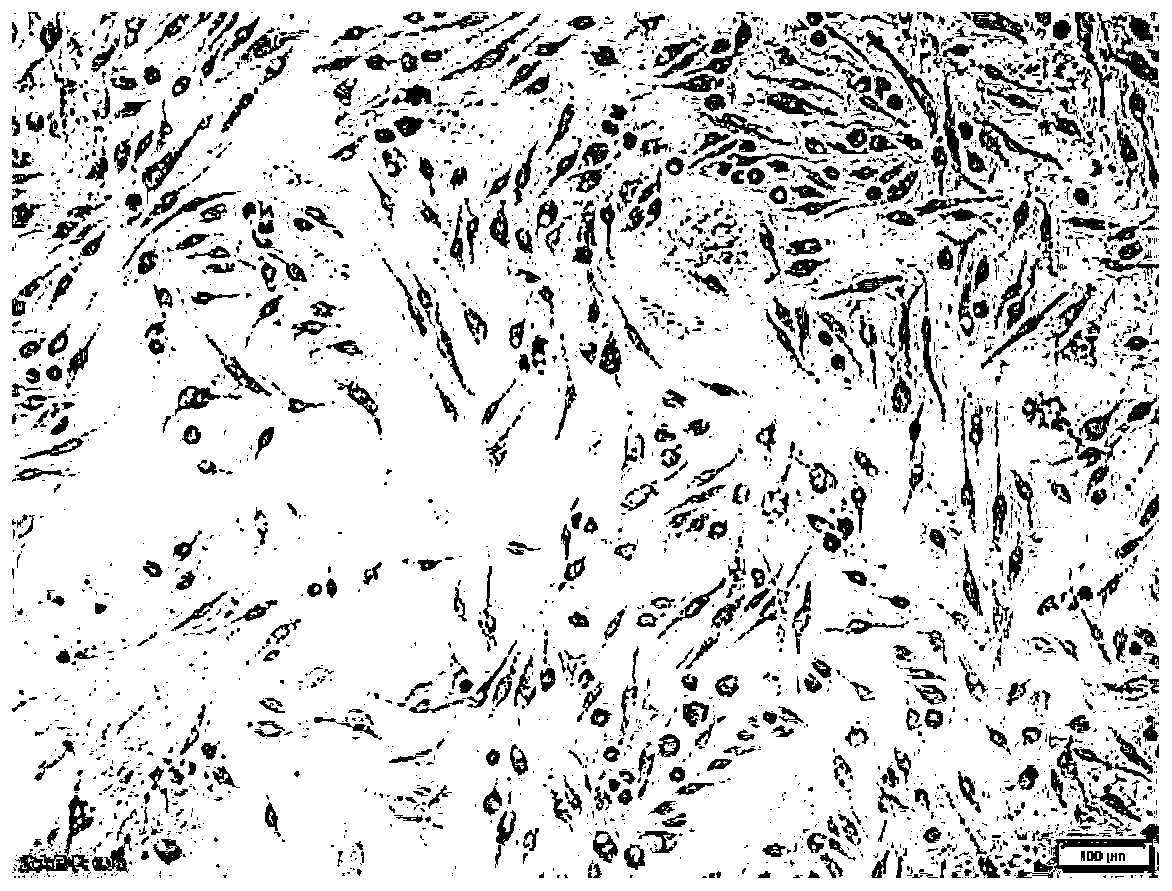 Preparation method of mouse bone marrow macrophages