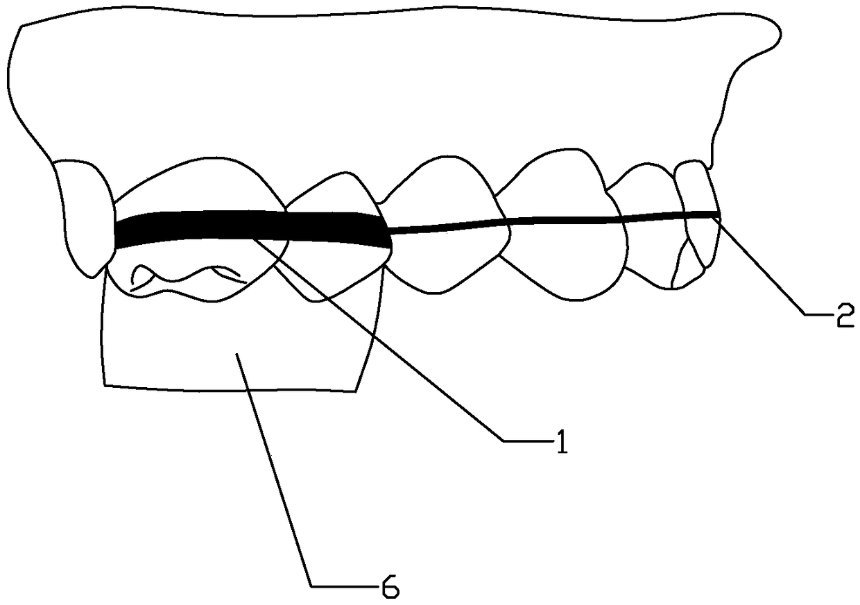 Oral appliance