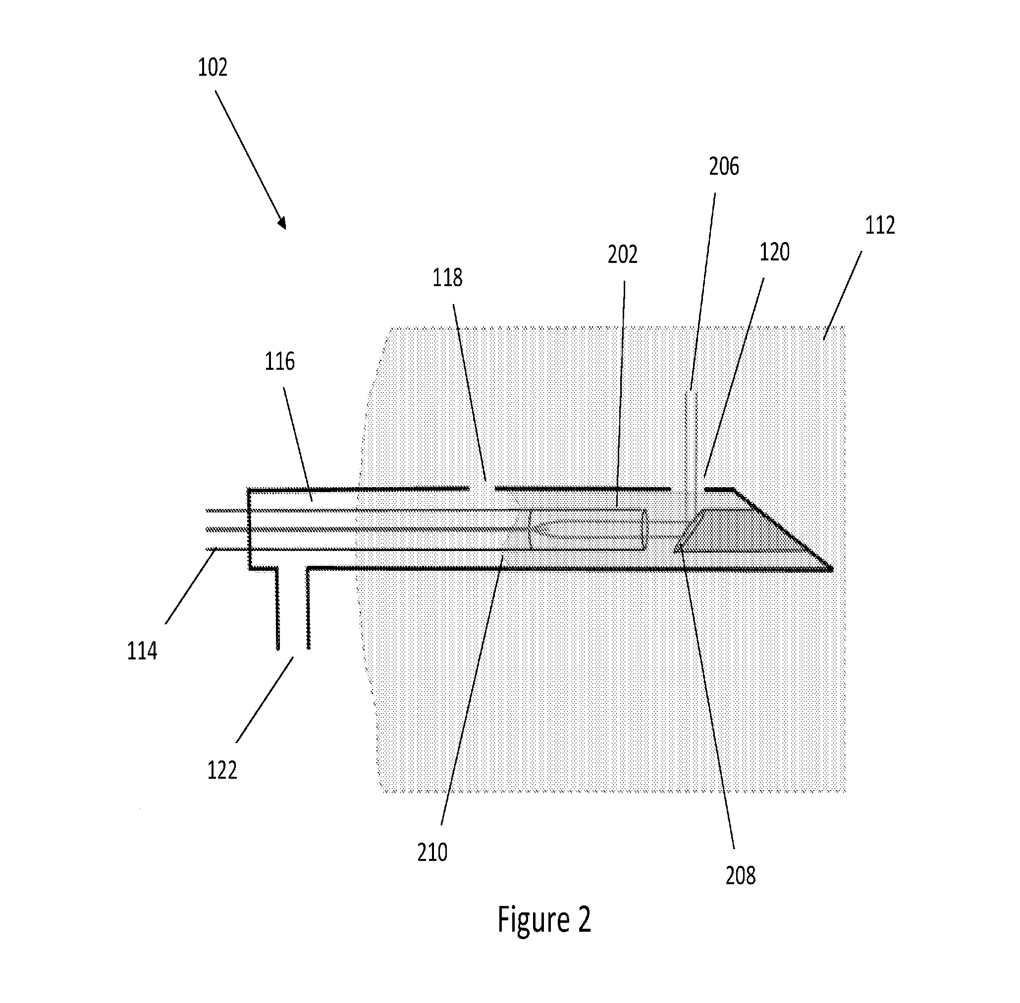 Method and system for characterising biological tissue