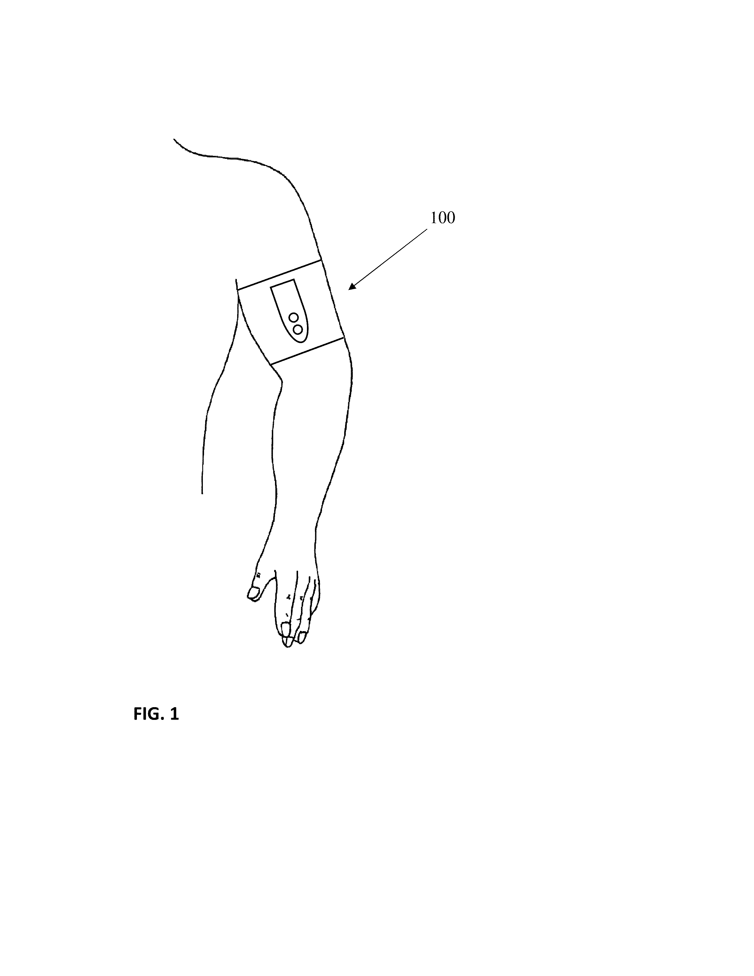 Dual mode remote ischemic preconditioning devices and methods