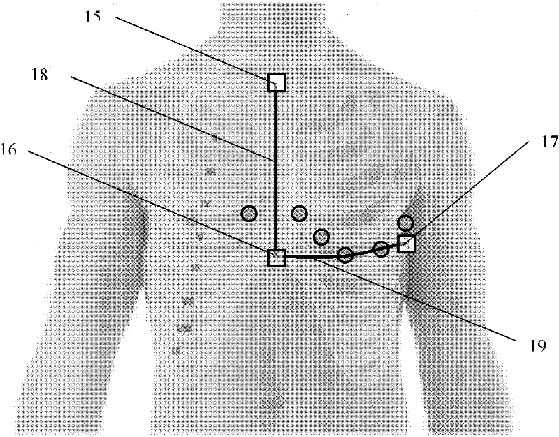 Electrocardio-electrode placement positioning device