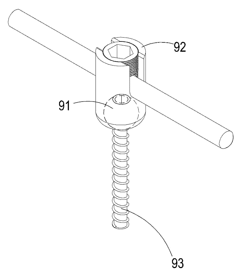 Bone fixing device