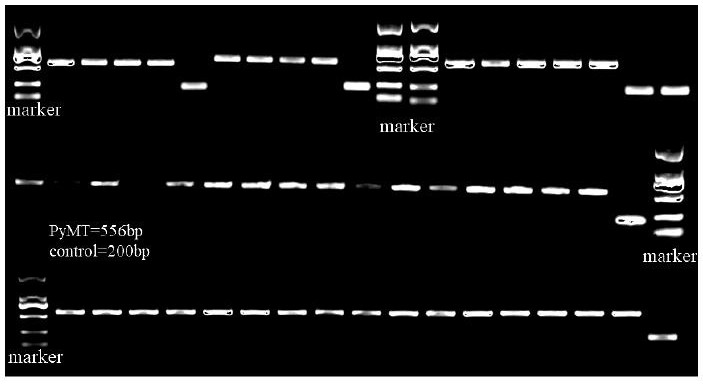 Construction method and device of depression-induced breast cancer animal model and application