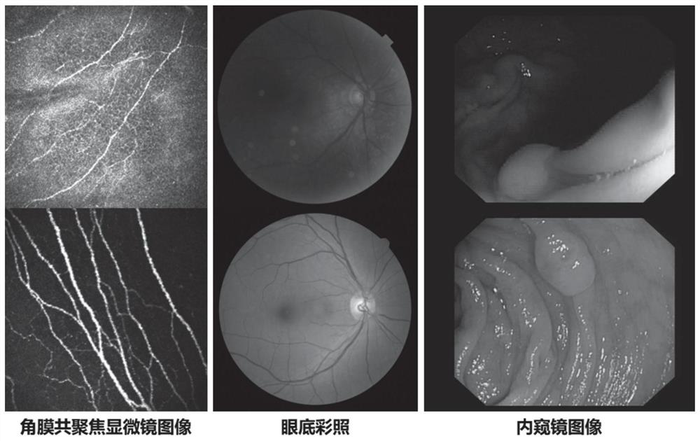 Medical image enhancement method