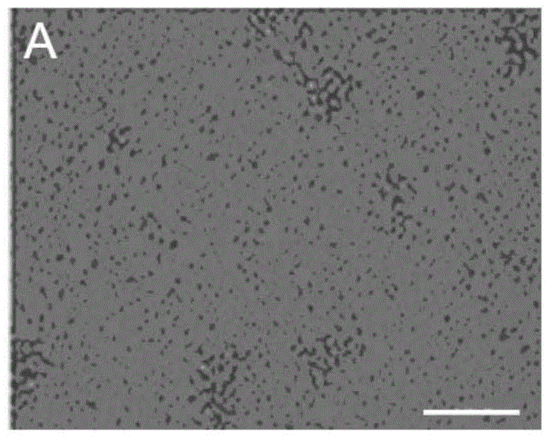 Method for preparing autologous hematopoietic stem cells, kit, the stem cells and application