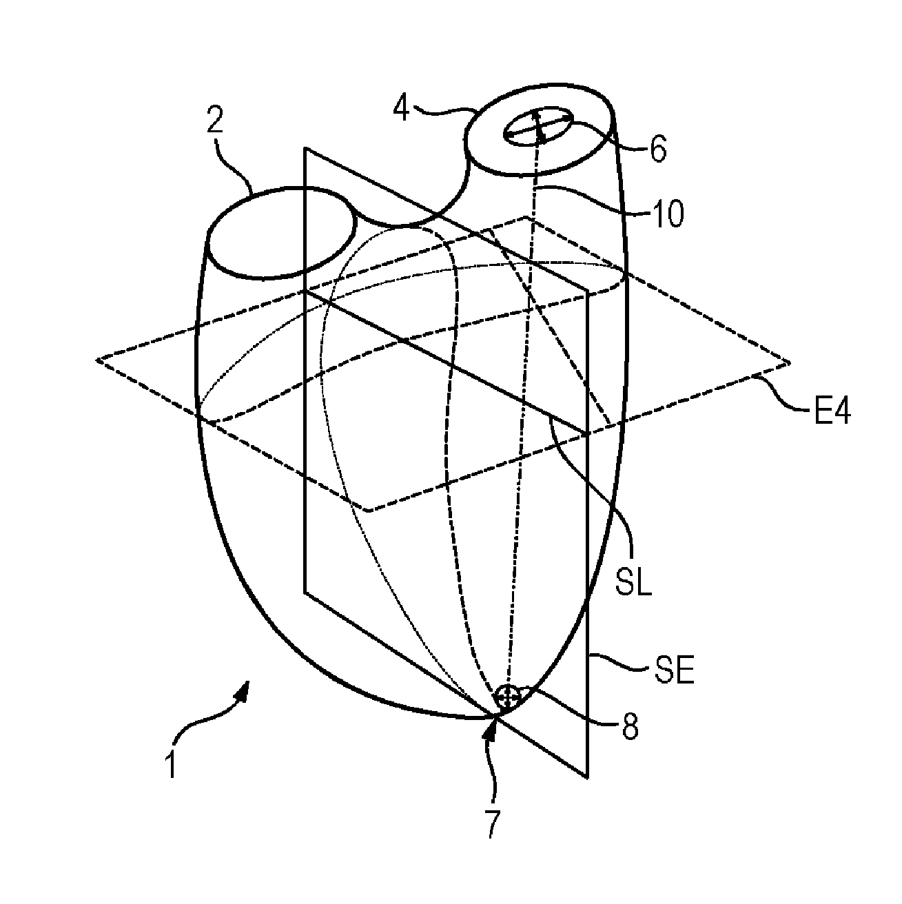 Adaptation of a 3d-surface model to boundaries of an anatomical structure in a 3d-image data set