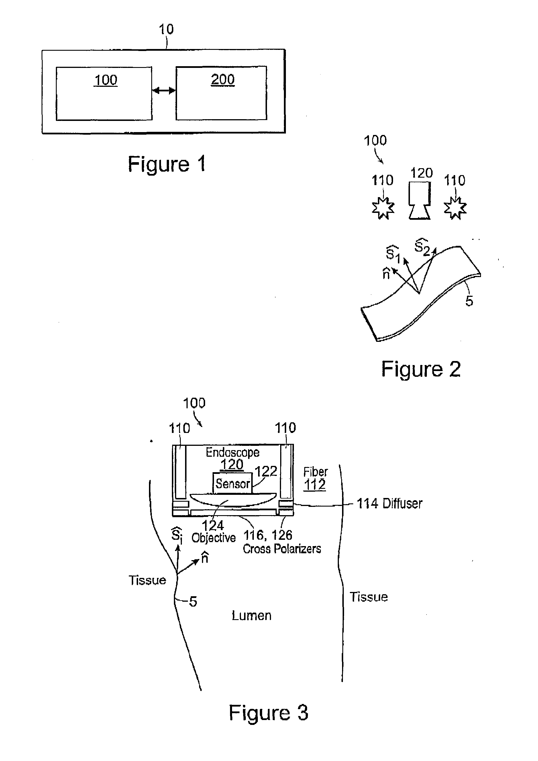 Photometric stereo endoscopy