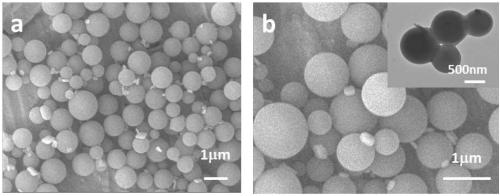 Composite microsphere with radial fibrous mesoporous shell layer/hollow nuclear layer structure and preparation method of composite microsphere