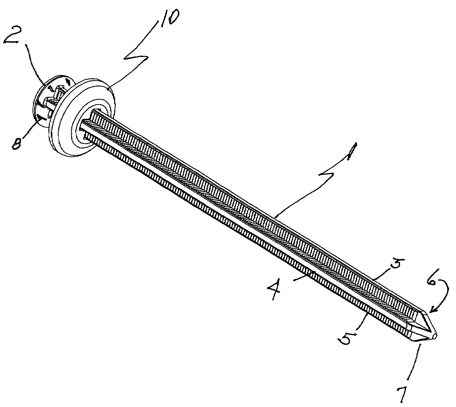 Zip tie anchor