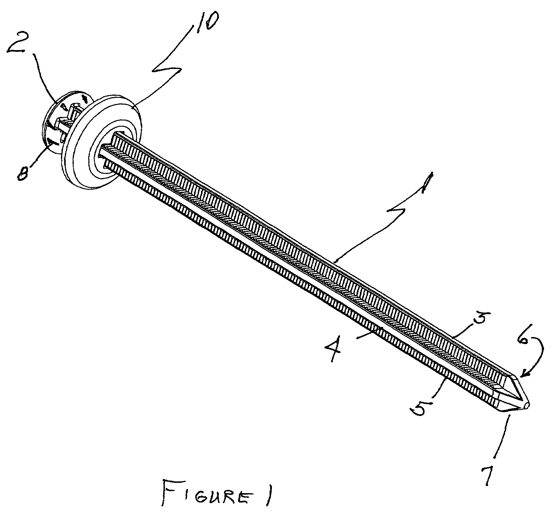 Zip tie anchor