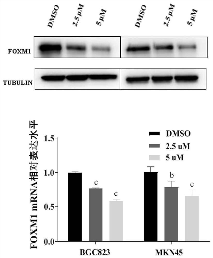 Application of sultan-cyclohexanone spiro derivative 1-3-51 in preparation of medicine for treating gastric cancer