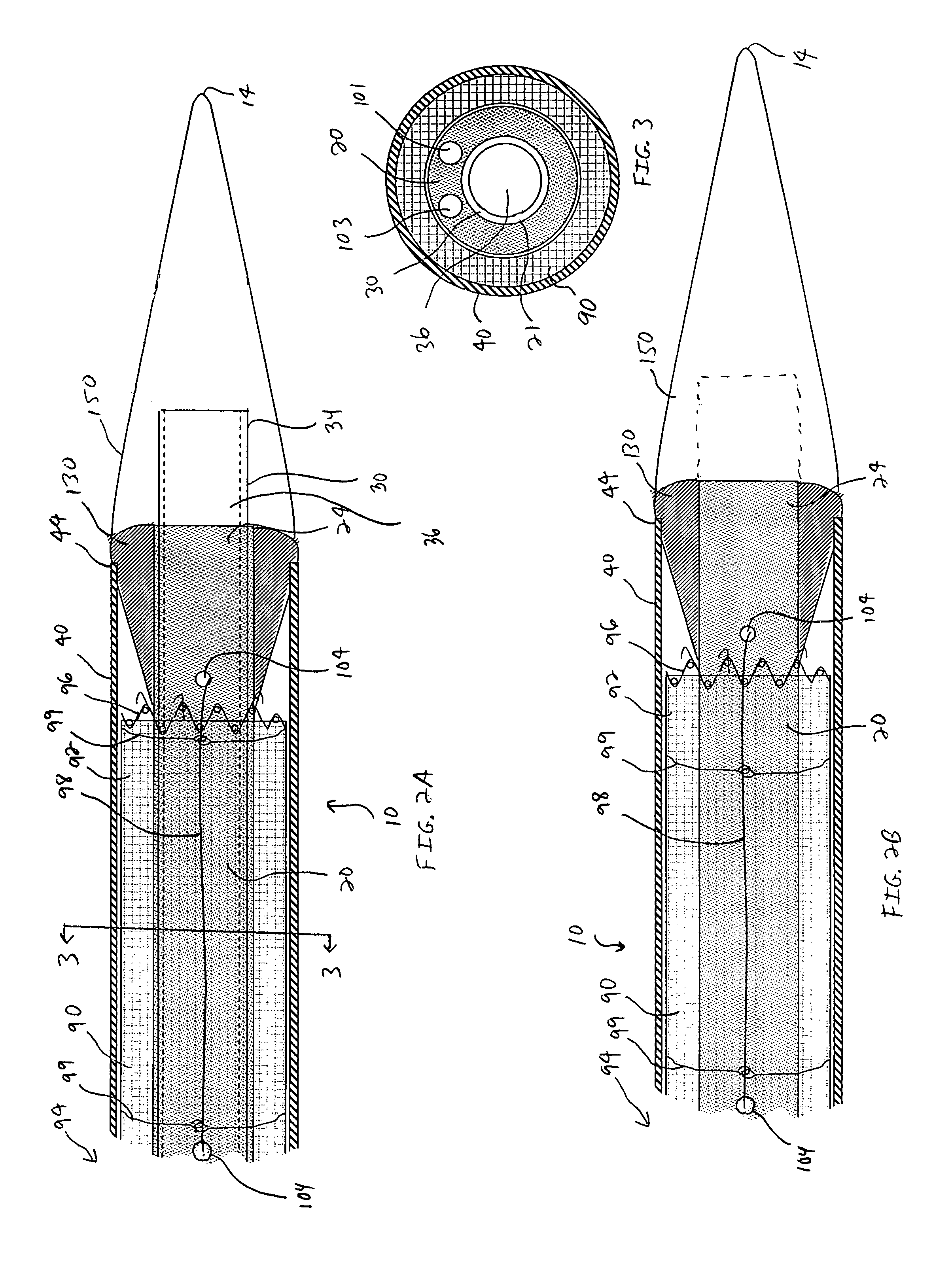 Steerable endovascular graft delivery system