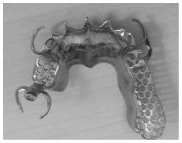 Whitening and self-cleaning coating of surface of titanium alloy dental prosthesis and preparation method of coating