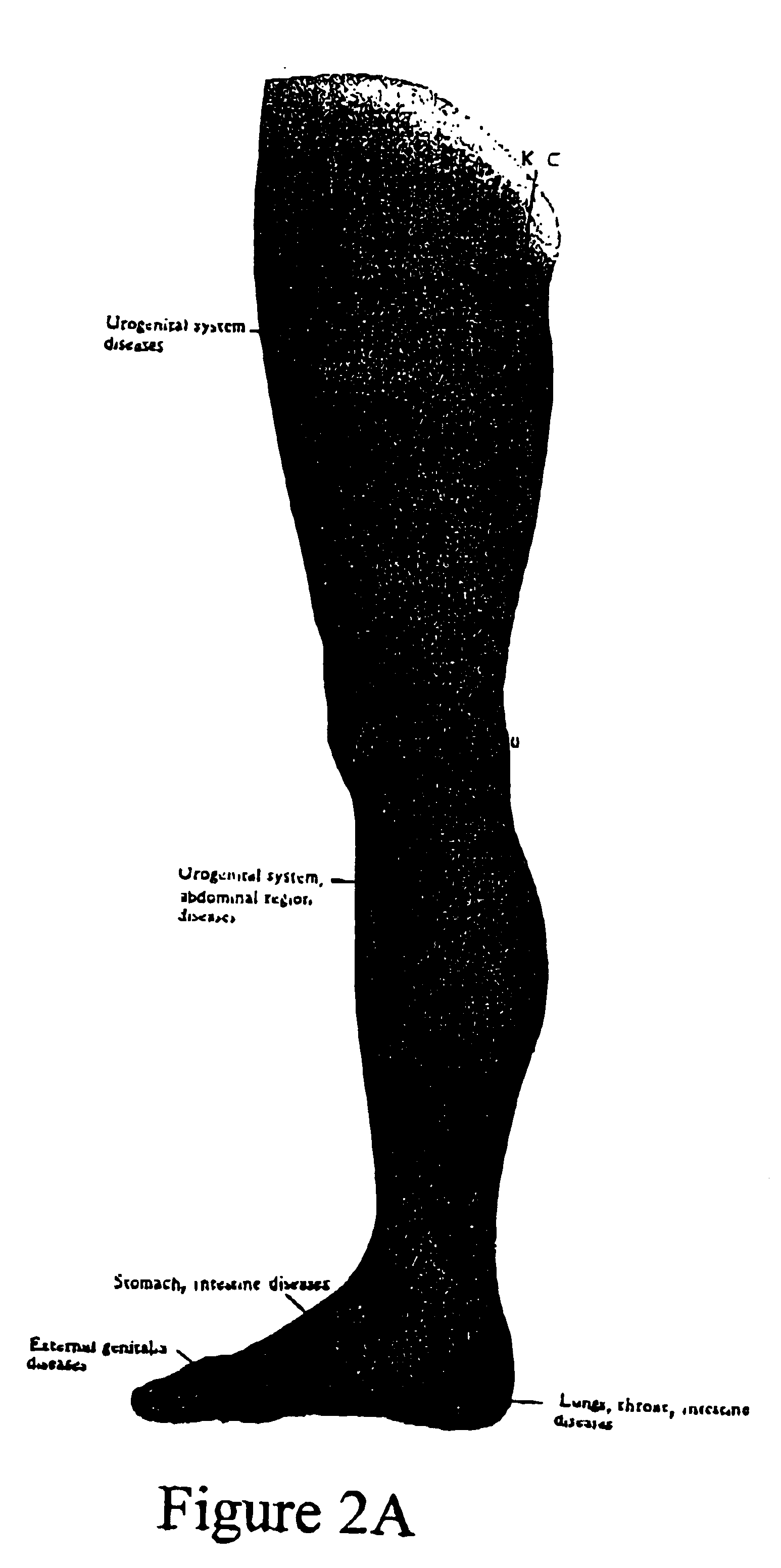 Laser ionization therapy system and method