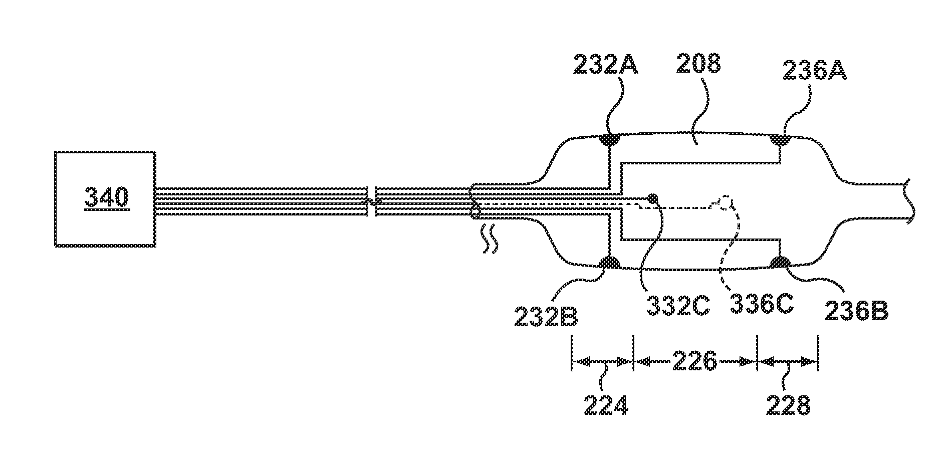 Stent Delivery System for Detecting Wall Apposition of the Stent During Deployment