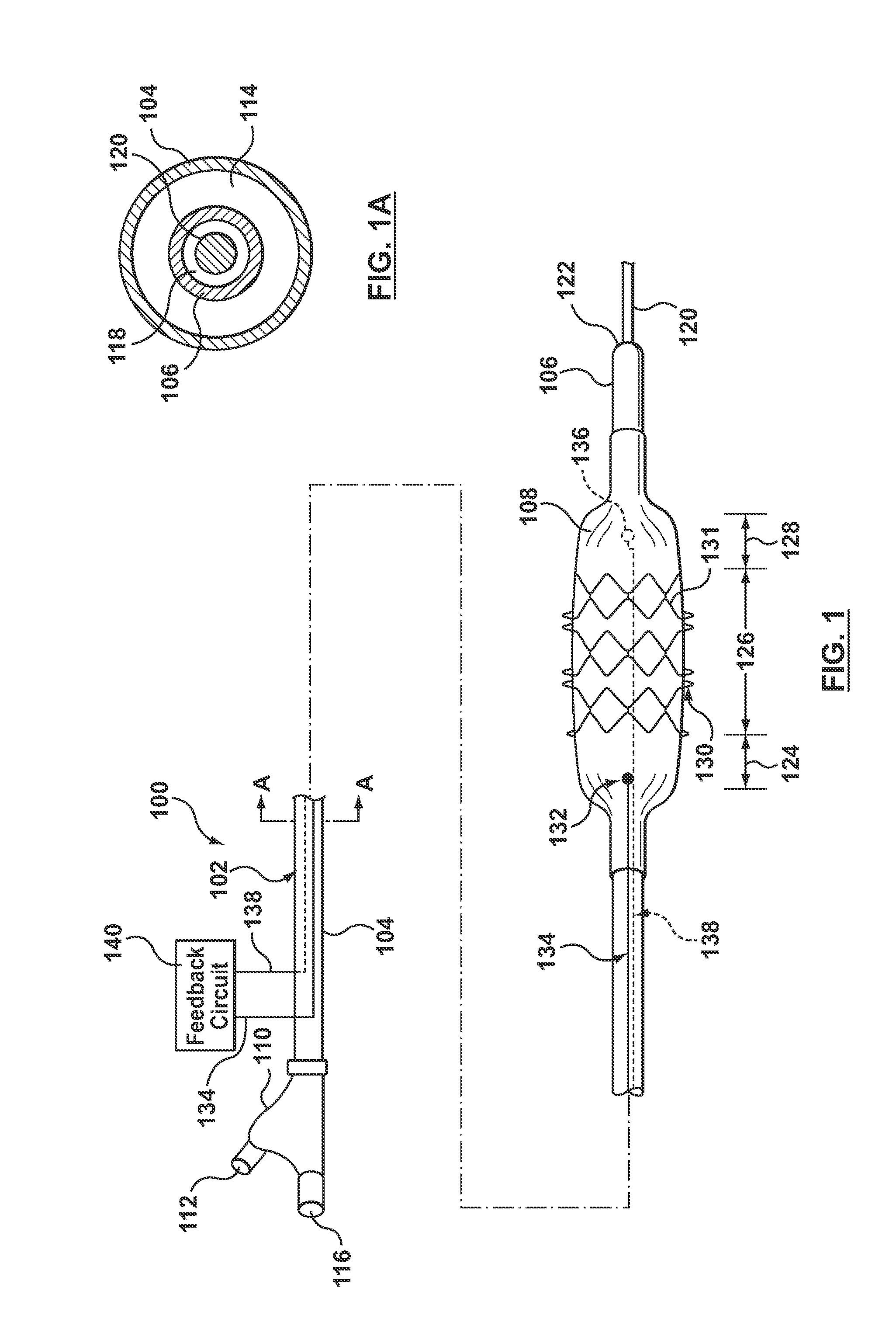 Stent Delivery System for Detecting Wall Apposition of the Stent During Deployment