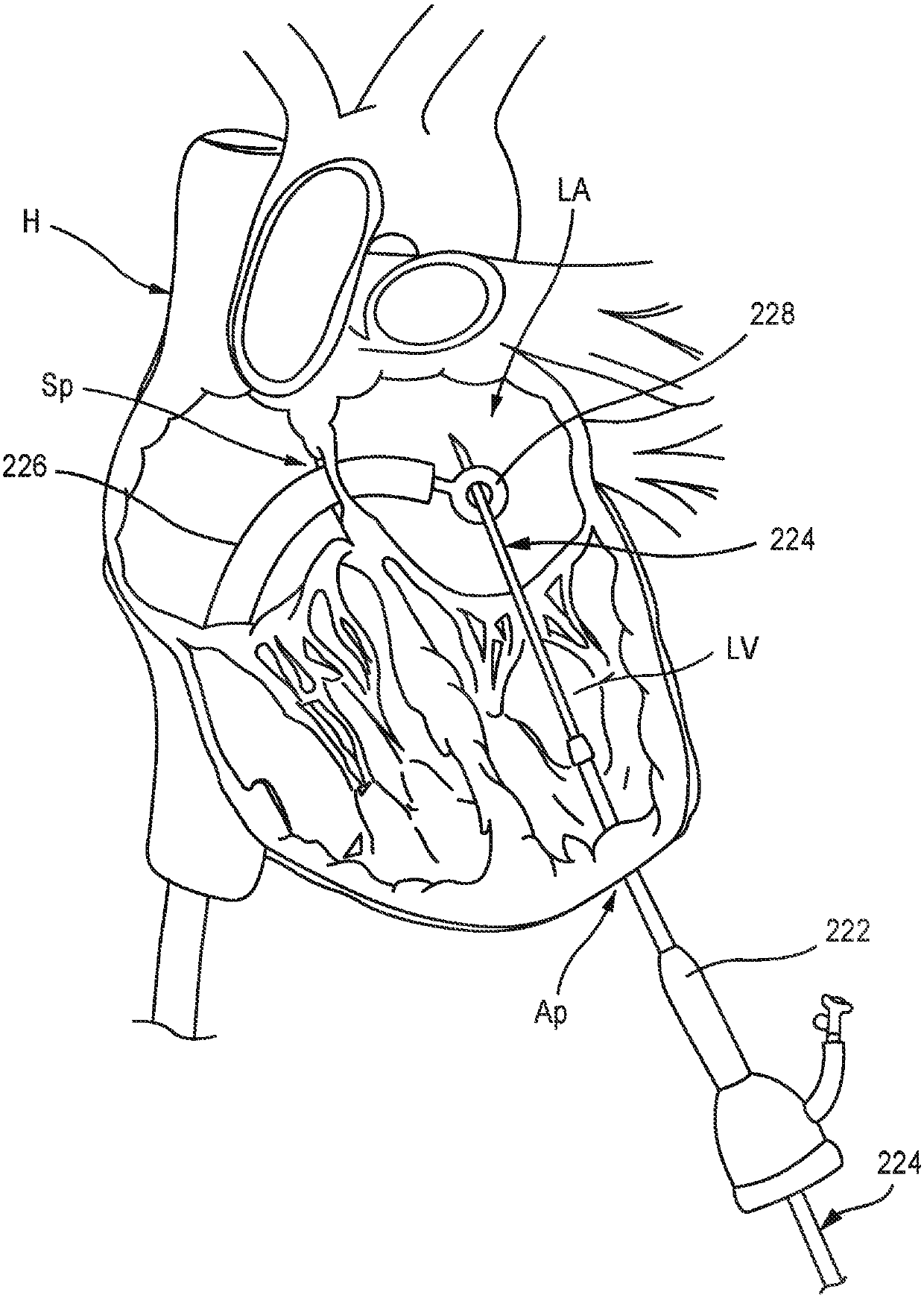 Expandable Epicardial Pads And Devices And Methods For Delivery Of Same